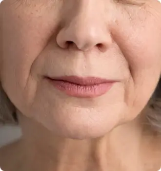 Skin Aging and Laxity