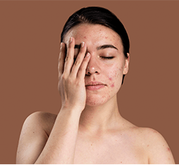 臉部出油嚴重、粉刺痘痘找上門？正確保養訣竅改善肌膚問題
