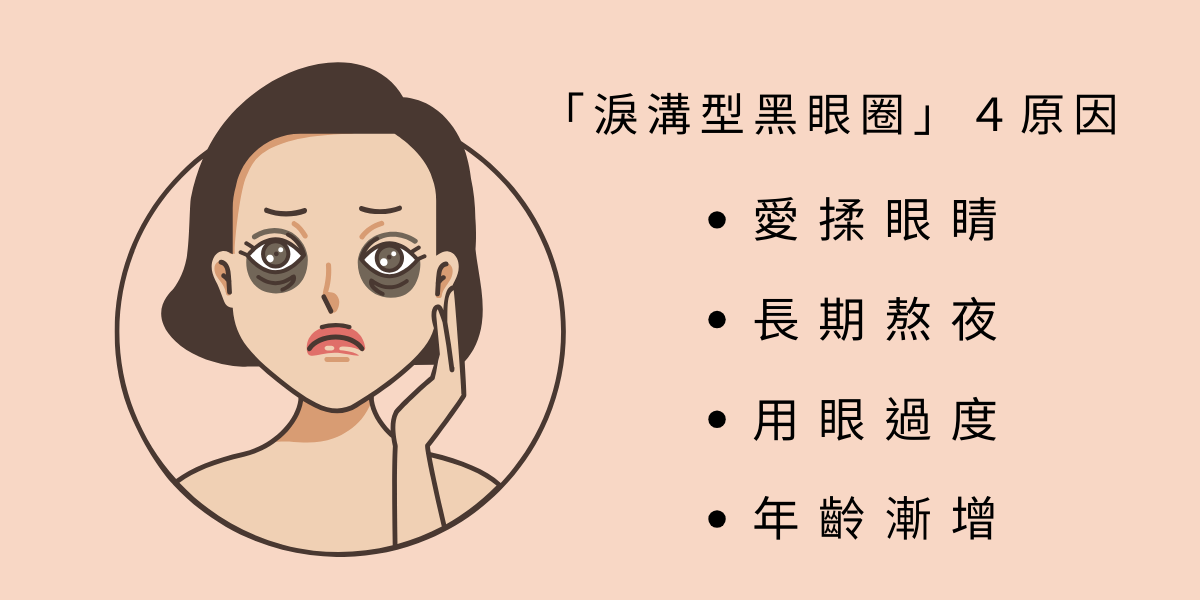 就黑眼圈而言，主要可分為以下三種類型：
1.淚溝型黑眼圈：因淚溝凹陷、眼袋膨出或蘋果肌下滑所致凹陷造成陰影。
2.血管型黑眼圈：因血管位置較淺，勾勒出黑眼圈的形狀。
3.色素型黑眼圈：皮膚色素沉澱、角質增厚、棘皮增厚或鬆弛等因素所引起。
同常客人都會有合併型跟單一類型，然而佔最多比例的就是：淚溝型黑眼圈，堪稱最為棘手類型！通常是一些平常不良生活習慣：常揉眼睛、長期熬夜和現代人常滑手機用眼過度加上年齡漸增老化造成。