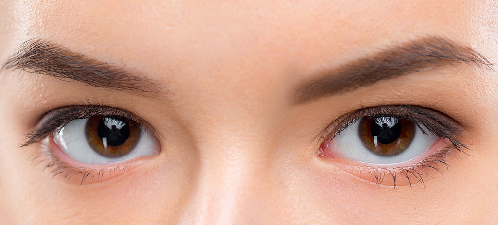 （一）雙眼皮：雙眼皮在視覺感官會帶給人感覺較有精神且隨和、好親近，而單眼皮的視覺感受比較無神、有自我個性及神秘距離感，可能比較難以親近。若先天眼皮皮下脂肪較少的人可以用「縫線」的方式（釘書機縫合）製造出雙眼皮折痕，術後消腫快、恢復期短；若眼皮皮下脂肪較多的人，建議採取用切割的方式，手術同時可切除過多的眼皮及皮下脂肪，手術時間稍較長、術後的修復也會較長一點。（二）眼睛形狀：常見所謂的桃花眼定義為偏長型，眼尾微微往上提，笑的時候又像月亮彎彎的眼型；若先天眼型較不理想，建議可先觀看兩眼間的距離，再去做眼頭或眼尾的手術調整。（三）眼下淚溝、眼袋、臥蠶：眼睛週遭的狀況也會影響整體的效果，例如眼溝、眼袋會讓人看起來感覺會顯得疲憊老態，可藉由眼袋切除手術及自體脂肪填補來解決問題。若淚溝的問題不太嚴重，想創造桃花臥蠶，則可以採用微整填充注射方式來處理，如玻尿酸、童顏針、精靈針、膠原蛋白增生劑，都可以填補凹陷、加強下垂組織支撐或刺激再生、並增加飽滿度。（四）眼周肌膚：表情豐富或愛笑的人常常會牽動到較多眼周肌膚，可能加速眼周肌膚的老化或紋路增生，常見的問題有魚尾紋，可利用注射肉毒桿菌來迅速撫平紋路，且效果可持續到半年左右。除此之外，也可能因年齡增長肌膚老化，導致眼周肌膚鬆弛、細紋變多，也可以採用鳳凰眼周電波，藉由電波熱能刺激膠原蛋白重組，精準改善眼周老化現象，消除眼周細紋及鬆弛狀況。
